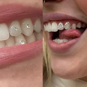 Tooth gem application adding sparkle at Halo Beauty